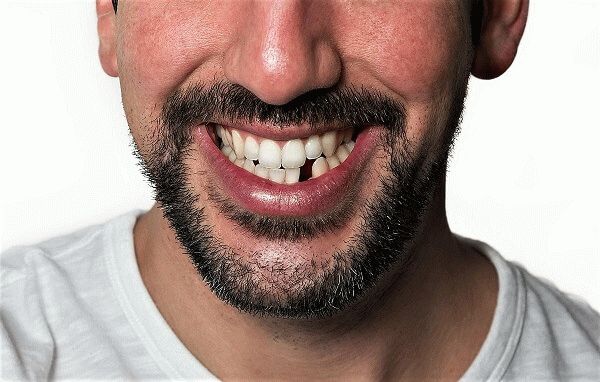 Можете ли вы классифицировать военнослужащих с плохими зубами?